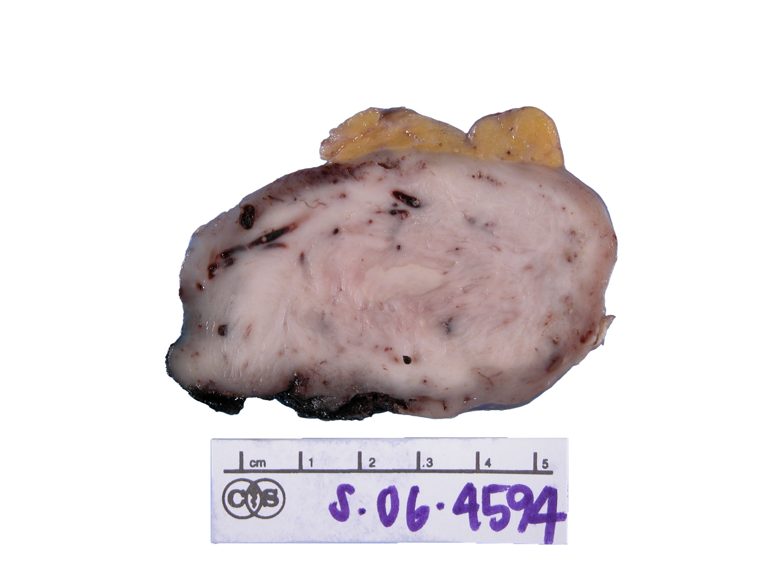 Breast tissue specimen captured with Model 702 system